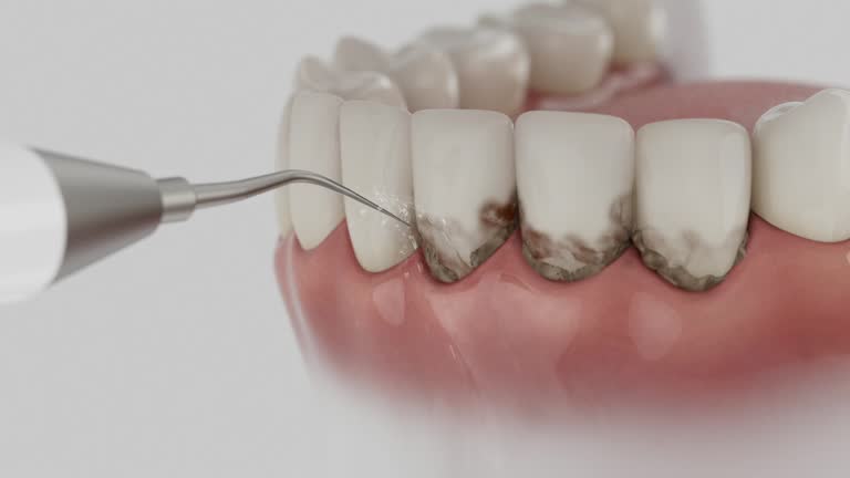 Reliable Root Canal Treatment contractor in Delaware County County, OH by Dentist Open Now
